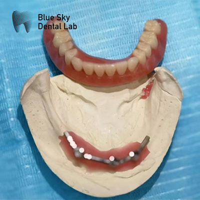 Blue Sky Implant Titanium Bar Dental Untuk Implantasi Gigi