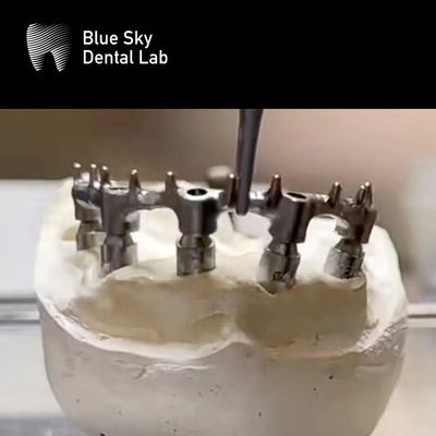 Prothesis yang bisa dilepas Ti Bar Titanium Dental Bar Dengan Kuku