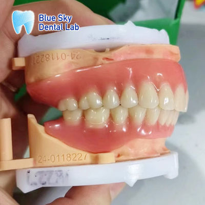 Full Arch Removable Acrylic Denture Customisable Natural Looking Denture