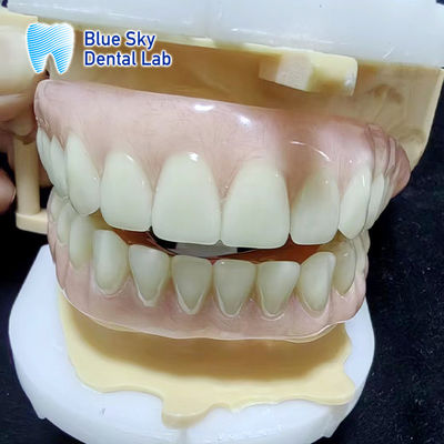 Bluesky sementara akrilik sebagian gigi palsu penuh atas dan bawah gigi palsu akrilik