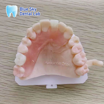 Natural Looking Removable Valplast Partial Dentures Untuk Gigi Atas dan Belakang