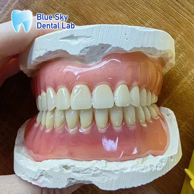 Gigi Hilang Akrilik Full Denture Restoration Akrilik Full Denture